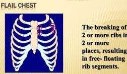 rib